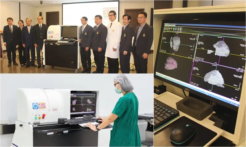 ม.อ.เปิดตัว MiniiScan เครื่องแรกของโลก ลดเวลา เพิ่มความปลอดภัย ในการรักษามะเร็งเต้านม